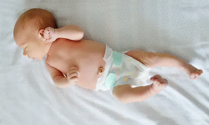 Newborn with outie belly button Newborn with outie belly button